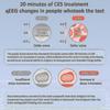 Sleep Aid Device Vagus Nerve Stimulation With Ear Clips Ces Reduce Anxiety Relieve Fatigue Microcurrent
