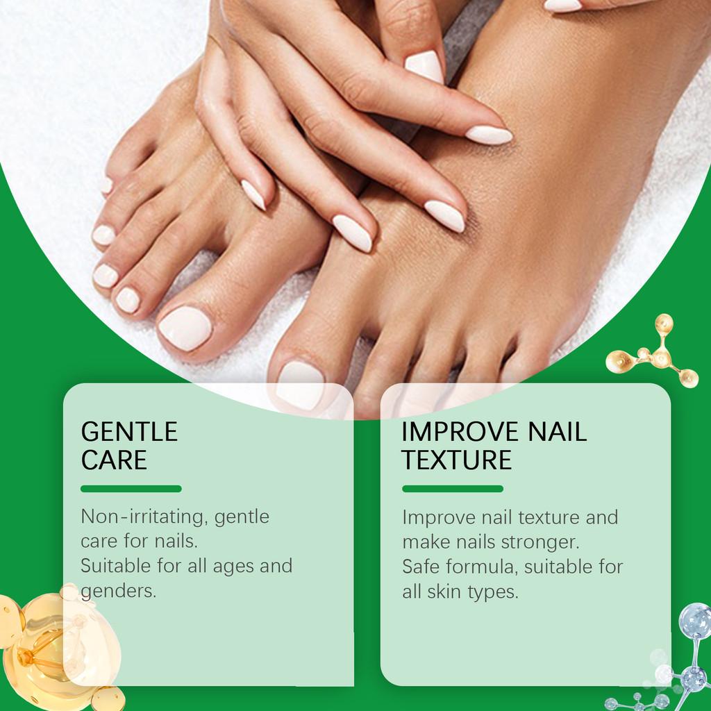 Eelhope Nagelreparaturflüssigkeit Nährende Formel Zum Erweichen Raue Nagelhaut Und Zur Verbesserung Des Glanzes 15ml