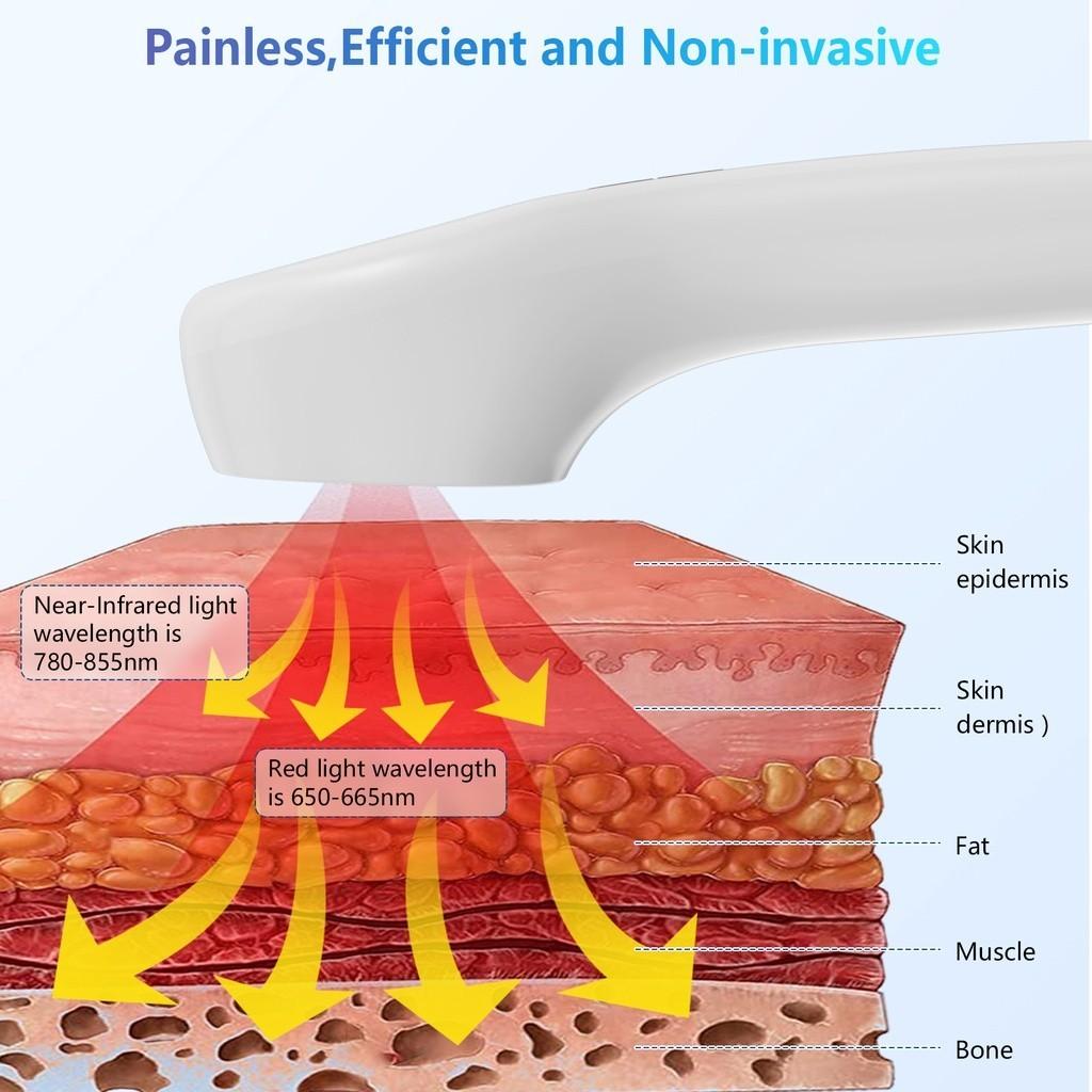 Physiotherapy Instrument Low Intensity Cold Laser Device for Pain Portable Relief Arthritis Cervical Pain Shoulder Soreness