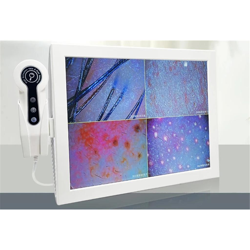 HD Digital Skin Analyzer Professional Hair Scalp Camera Detector Hair Follicle Oil Moisture Test Device 15inch