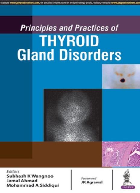 Bok Principles and Practices of Thyroid Gland Disorders