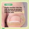 The Nail Improvement Tool for The Nail Groove - Isolates The Toenail, Allows for The Growth of The Nail, and Fills In The Area with A Padding Pad.