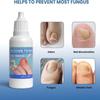 Ingrown Toenail Treatment Extra Strong, 20ml Ingrown Toenail Drop, Cuticle Care Oil for Ingrown Toenails, Fungal Nail Treatment
