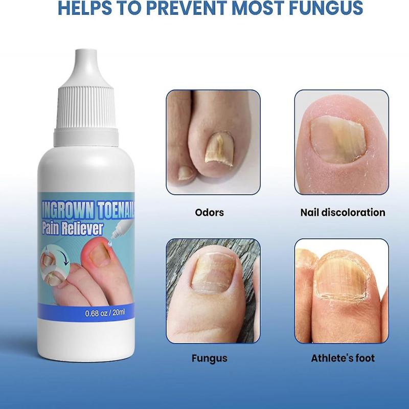 Ingrown Toenail Treatment Extra Strong, 20ml Ingrown Toenail Drop, Cuticle Care Oil for Ingrown Toenails, Fungal Nail Treatment
