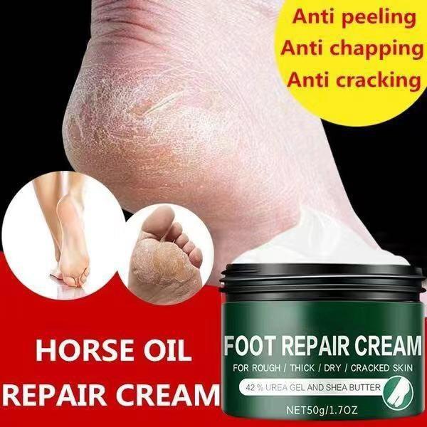 2021 Effective Odor Treatment Nourishing Anti Cracking Cream Skin Care Products Dead Skin Remover Chapped Repair Cream