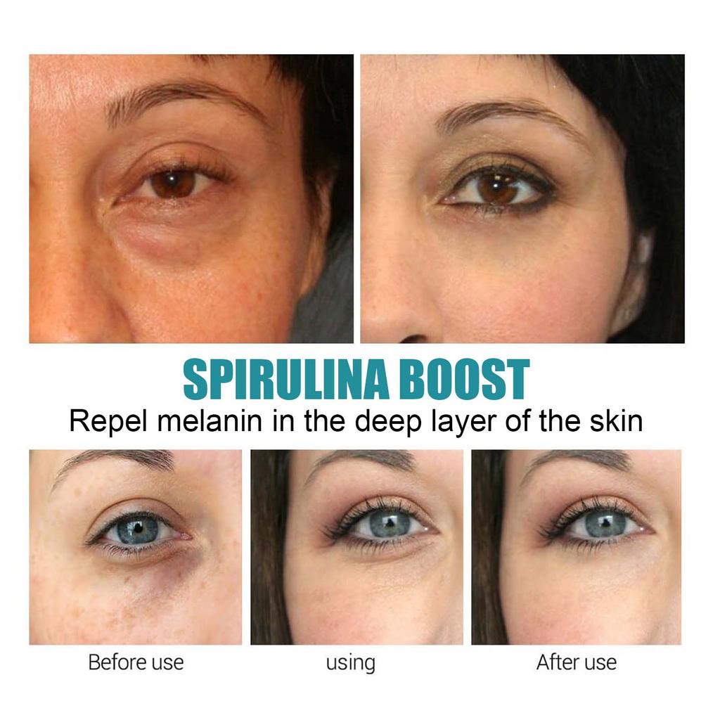 EELHOE Gel pentru ochi anti cerc întunecat Îngrijirea pielii Peptide Pungi pentru ochi Cremă cu acid hialuronic antirid Masaj cu role Frumusețe Sănătate