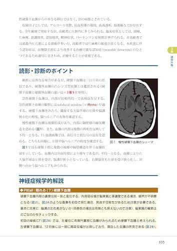 Mastering Head CT and MRI Imaging and Interpretation
