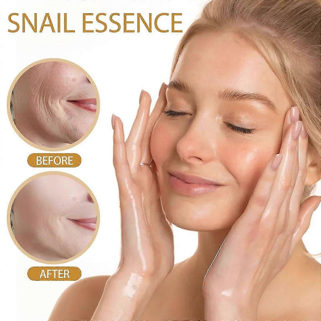 Snail Essence Serum - Hydrating, Anti-Wrinkle, Pore Repair, Skin Barrier Support, 100ml
