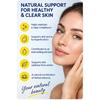 Wixaderma – From Skin Pigmentation And Acne: 30 Capsules