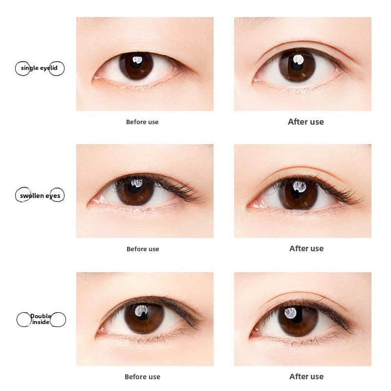 UNNY Simulation Lace Double Eyelid Stickers - Traceless, Invisible, Natural Eye Shaping for Women