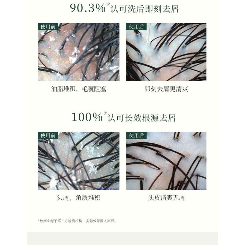 FAPOPRO - Scalp Oil Control Anti-Dandruff Shampoo