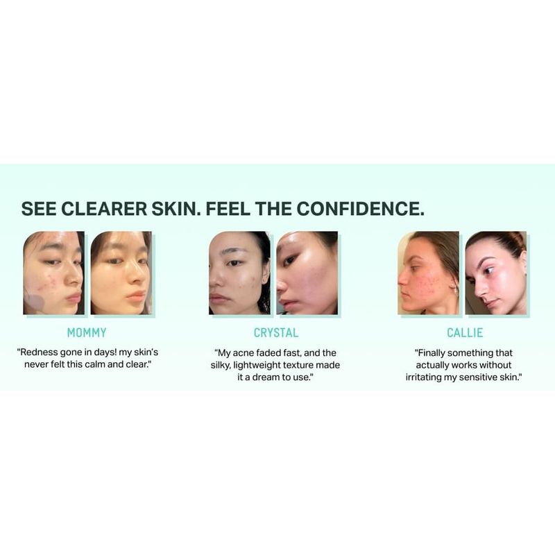 BRING GREEN - Zink Teca Unreinheiten Serum