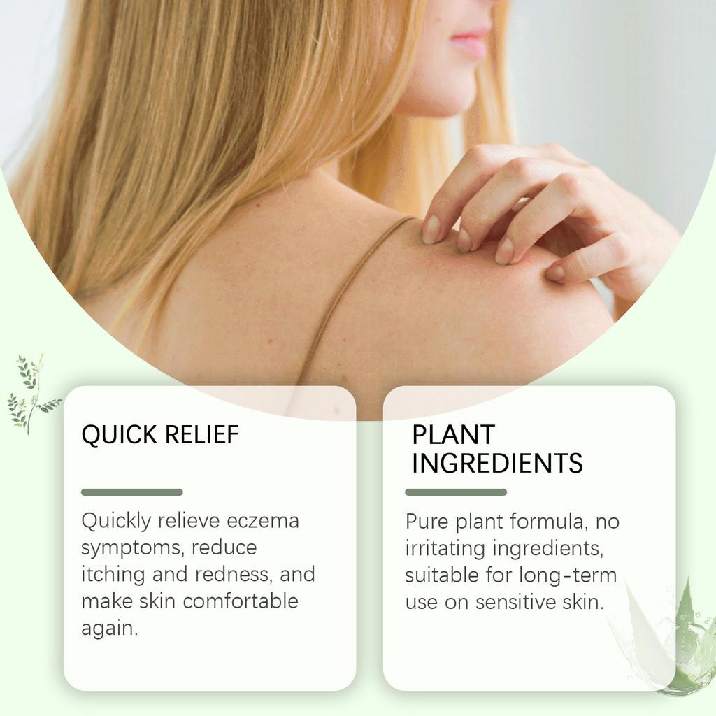 Woodsleep Herbal Cream Natural Formula For Soothing Skin Redness And Bumps