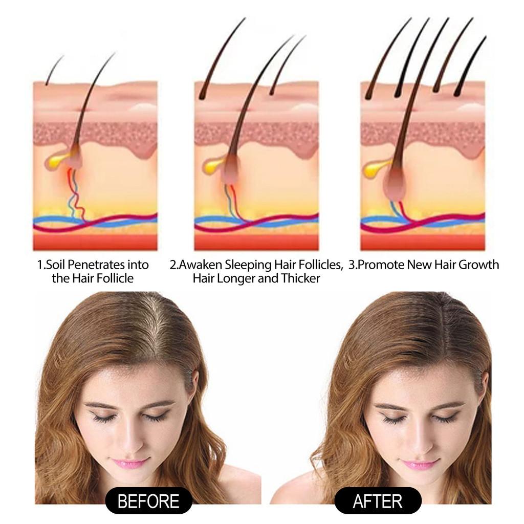 Eelhoe Black Lingzhi He Shou Wu Shampoo For Natural Black And Thick Hair Nourishing Scalp And Smooth Hair Care