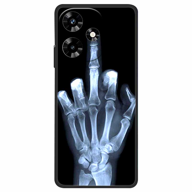 For Infinix Hot 30 Case Shockproof Soft Silicone TPU Phone Cover For Infinix Hot 30 4G 5G X6831 Back Cases Cute Cartoon Fundas