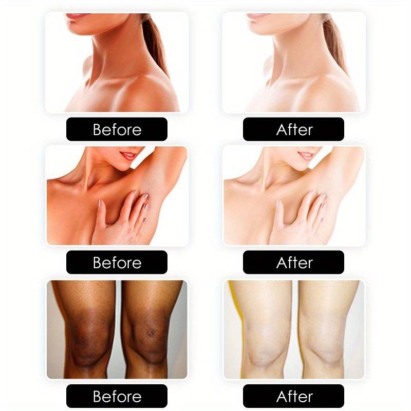 VC Skincare Soap for Body Moisturizing Cleaning Joints Elbows Skin Melanin Brightening and Whitening Soap