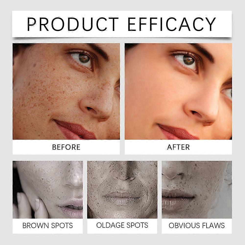 Dark Spot Corrector Serum Reduce Sun Spots & Age Spots Anti-Hyperpigmentation for Face & Body