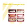 Propolis Gum Care Gel, Propolis Oral Gum Repair Gel, Propolis Teeth Regrowth Dental Gel, Gum Instant Soothing Gel