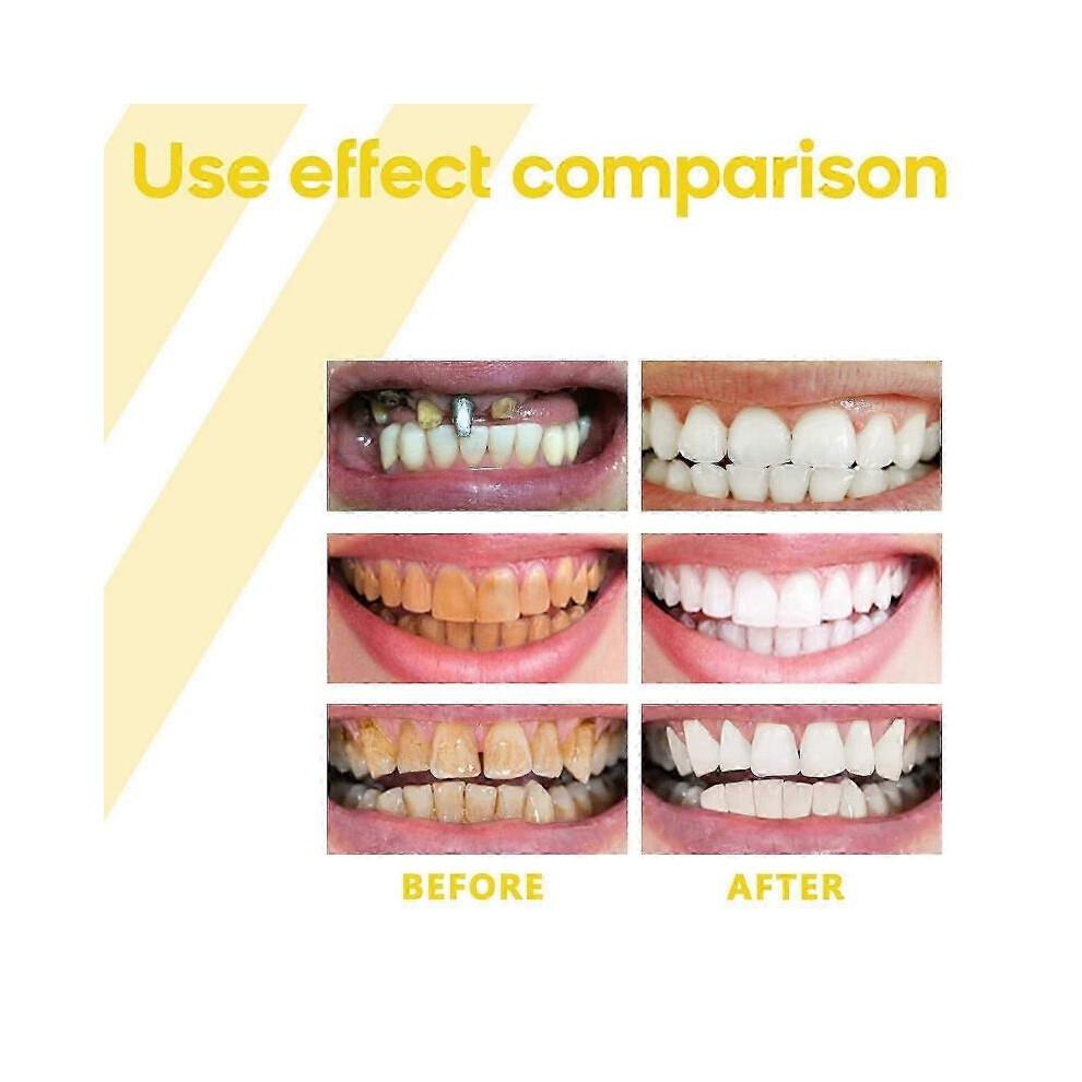 Propolis Gum Care Gel, Propolis Oral Gum Repair Gel, Propolis Teeth Regrowth Dental Gel, Gum Instant Soothing Gel