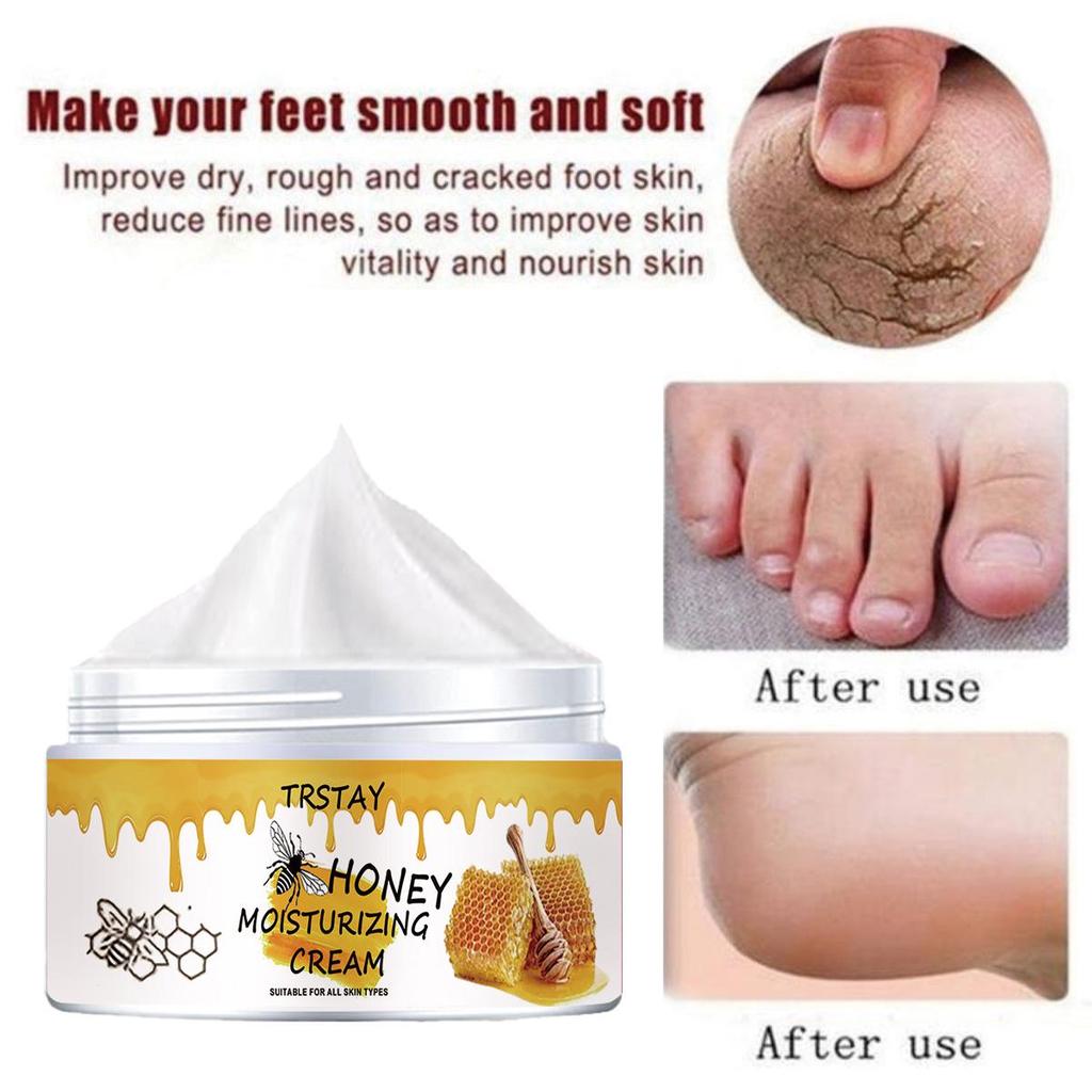 Chapped Hands and Feet Repair Cream, Moisturize, Nourish the Skin, and Leave the Skin Soft and Delicate