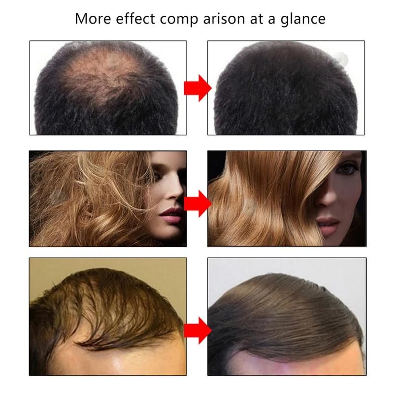 Liquide de soin hydratant pour la croissance des cheveux Favorise la croissance des cheveux, prévient la chute des cheveux, épaissit les cheveux Huile essentielle de soin