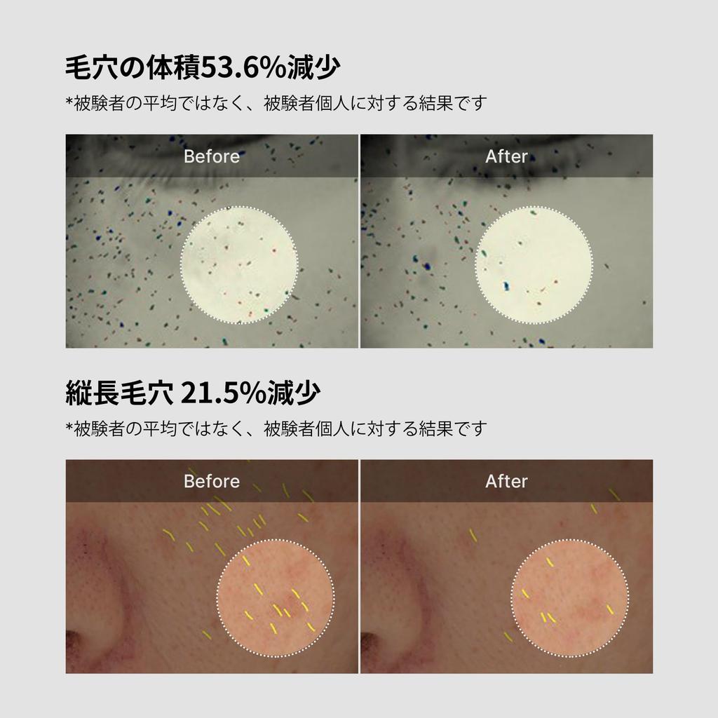 Medicube Zero Pore One-Day Cream 50ml, Exfoliating Care, Korean Cosmetics, For Rough, Sensitive, Dry Skin, Skincare, Zero Line
