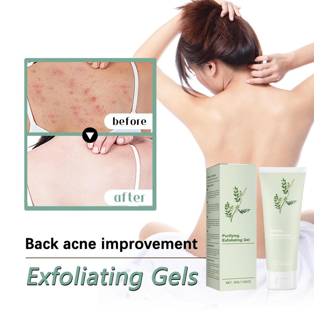 Kuangjie Purifying Exfoliating Gel – Gentle Cleanser for Fine Pores & Brightening