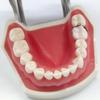 New Dental Matrix Bands Sectional Contoured Metal Matrices Matrix For Teeth Replacement Dentist Tools Dentistry Material