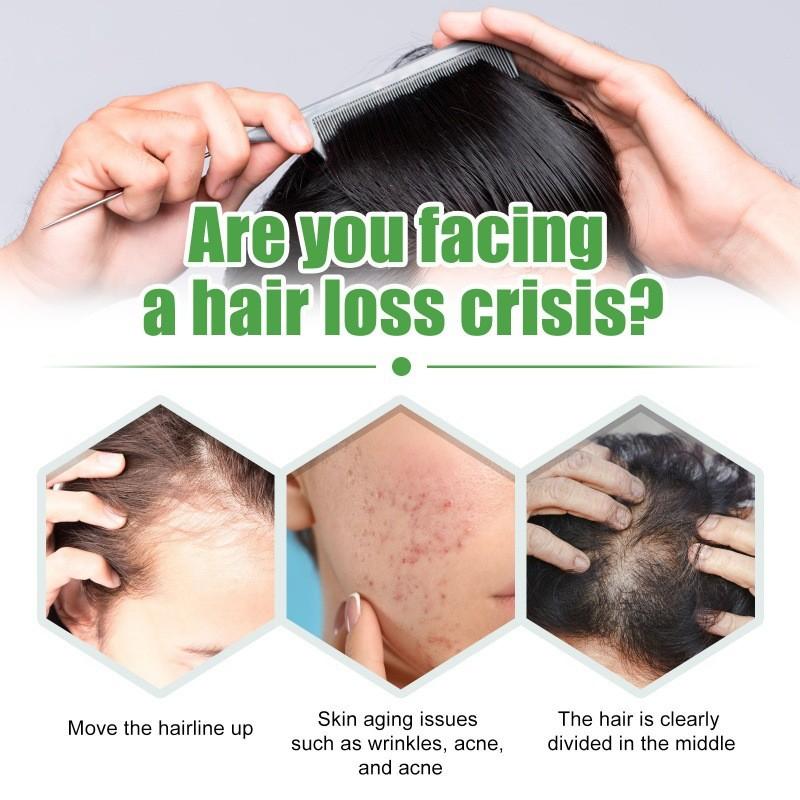 Eelhoe Castor Oil Hair Growth Serum Nourishing And Strengthening 30ml For Thicker Hair