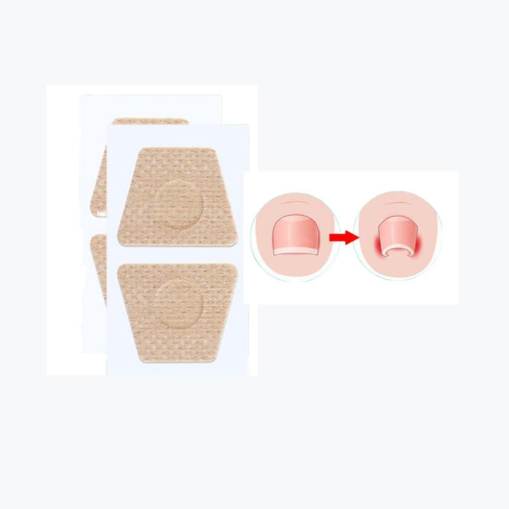 10/2PCS Nail Fungus Treatment Patches  Repairing and Improving Appearance of Damaged  Discolored  and Thick Nails  Toenail Fungus Removal Tools