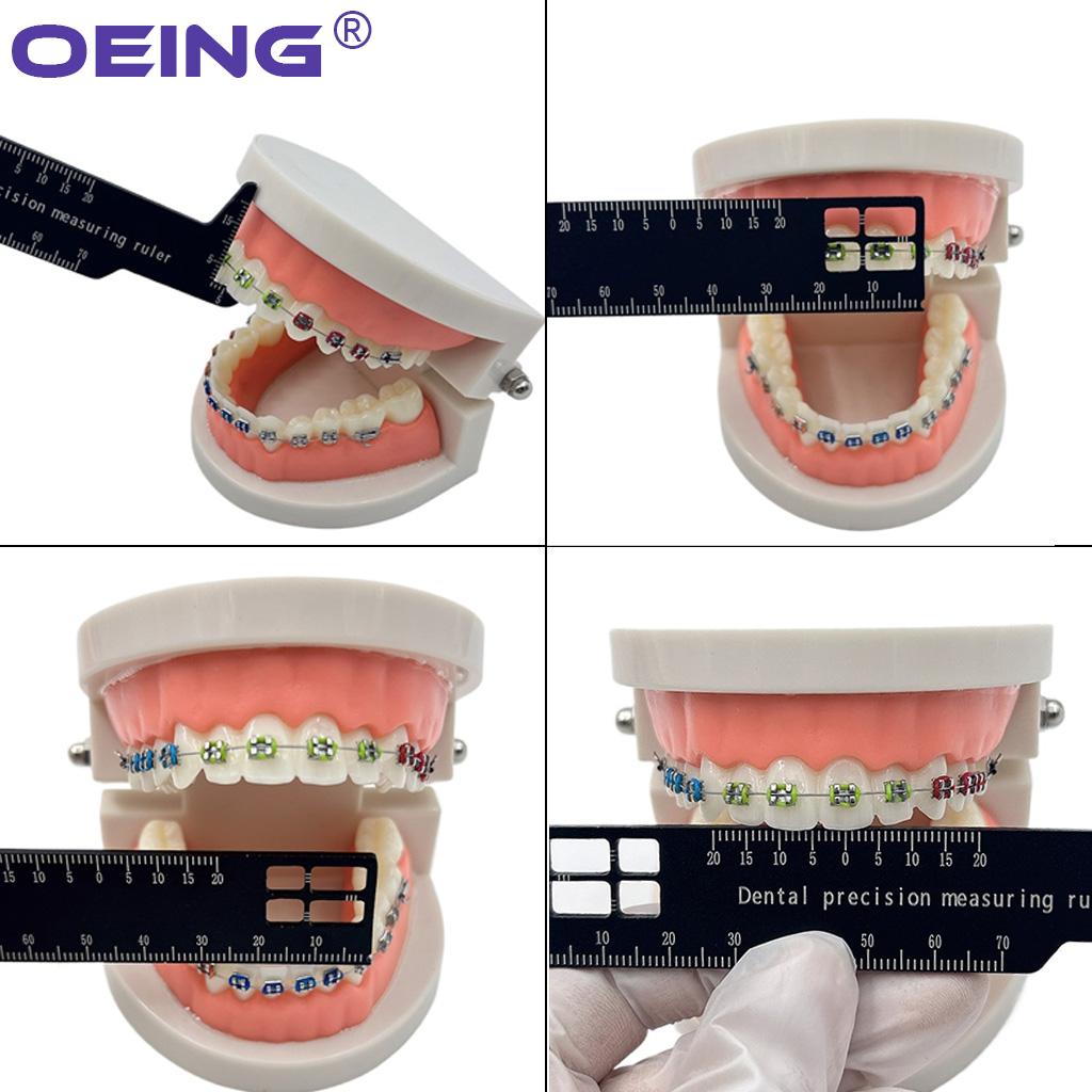 Dental Precision Measuring Ruler Tooth Gap Photography Dentistry Gauge Span Measure Scale Endodontic Instrument Orthodontic Tool