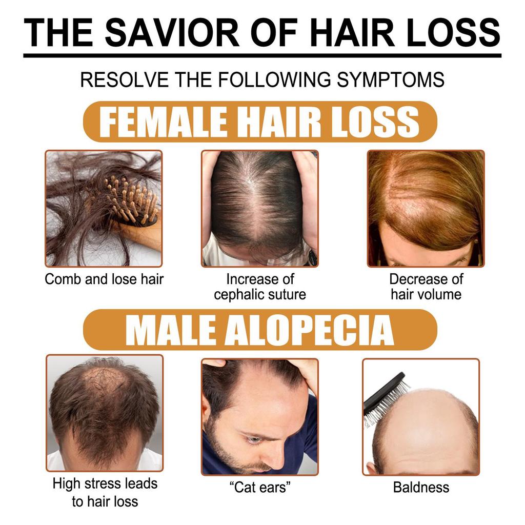 EELHOE Rice Water Hair Oil, Repair for Permed and Dyed Damage, Improves Dry and Frizzy Hair, Moisturizing and Softening Hair Essence 30ml