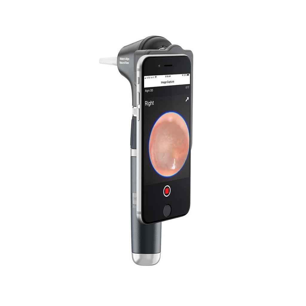 KASHSURG Welch Allyn MacroView Plus Otoscope Head