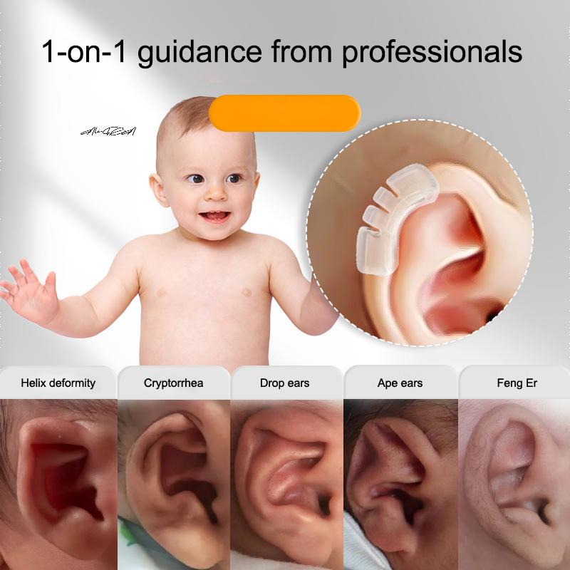 Silikon Baby Ohrkorrektur Abstehende Ohren Unterstützung Ohrmuschel Valgus Korrektur Patch Baby Ohrenstützwerkzeug für Deformierung