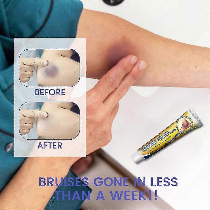 Bruising Removal Cream Joint Muscle Injury Swelling Pain Relief Ointment 30G