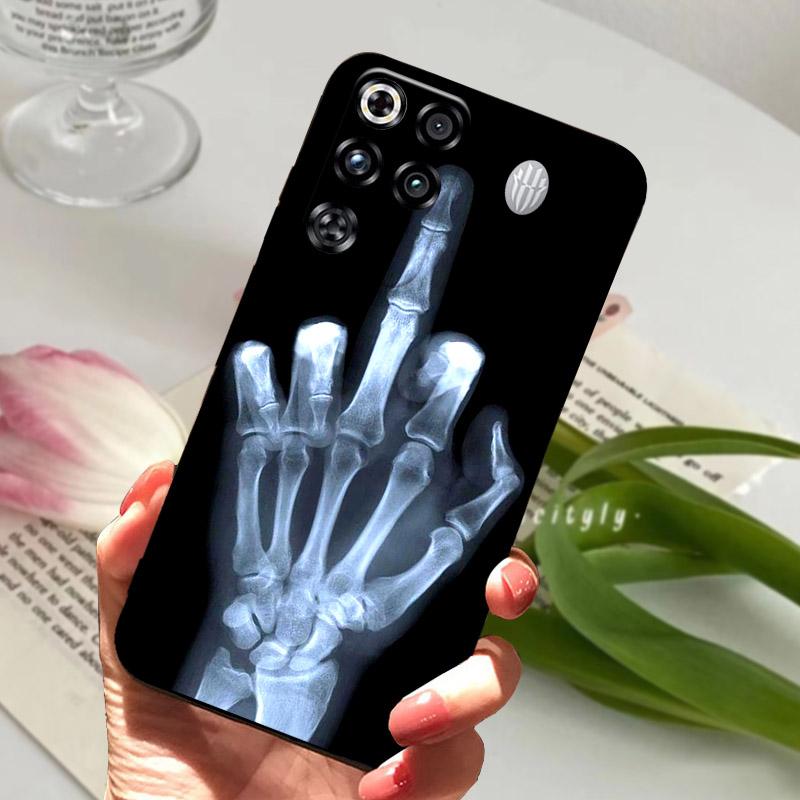 For ZTE Nubia Red Magic 11 Pro Pro+ Case New Fashion Silicone Soft TPU Phone Cover For RedMagic 11 Pro Plus 11Pro Fundas Bumper