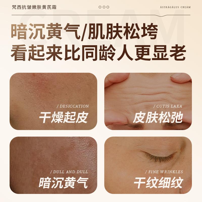 Anti Wrinkle and Skin Rejuvenation Huangqi Cream