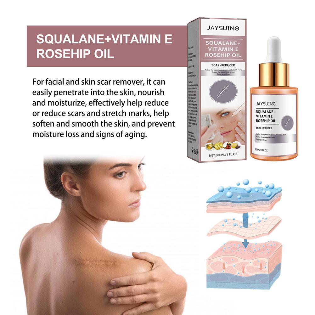 Scar Surgery Scar Dilution Cream To Burn The Impression Scar Dilution Surgery Beard Cream Remov I3U7