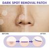 Dark Spot Correcting Patches Freckles Remover Brightening Fade Fade Dark Spots Lightening Melasma Facial Invisible Care Stickers