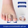 Silicone Bunion Toe Separator and Corrector for Overlapping Big Toe - Unisex, Wear with Shoes