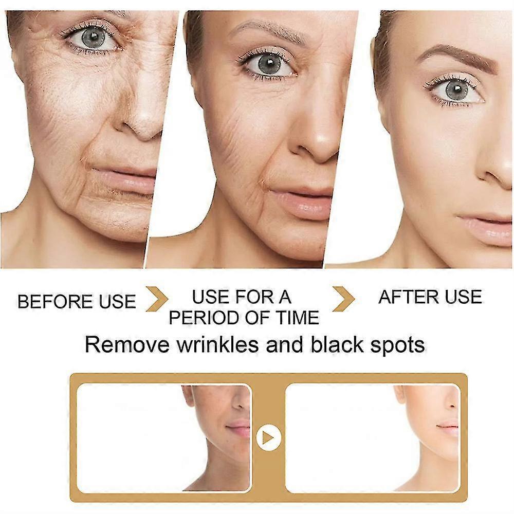 3pcs Turmeric Skin Glow Face Serum Dark Spot Whitening Black Patches Melasma Corrector Brightening Anti-aging Skin Care