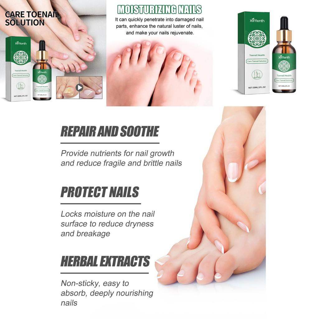 Ximonth Nourishing Toenail Care Liquid For Healthy Strong Nails And Beautiful Shine
