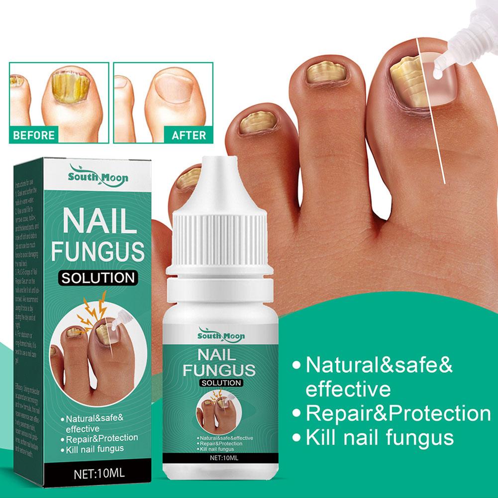 5Pcs Extra Strong Nail Fungus Treatment Serum Essence Care Repair Essence Anti Toe Infection Gel Feet Serum Removal Nails Fungal