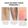 Hair Removal Spray for the Whole Body, Underarms, Legs, Hands, and Armpits, Gentle and Non-drying, Hair Removal and Hair Suppression 100ml