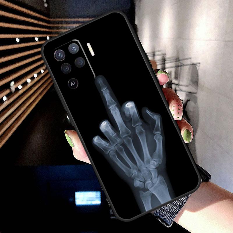 Middle Finger Case For Oppo A74 A54 A94 A80 A60 A40 A18 A38 A58 A78 A98 A96 A76 A16 A15 A17 A57 A77 A5 Pro