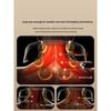 AUX Cervical & Shoulder Massager with Heat - Rose Gold CN plug (adapter included)