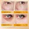 Retinol Anti Wrinkle Eye Serum Peptide Remove Dark Circles Eye Bags Puffiness Cream Moisturizing Repairing Korean Skincare New
