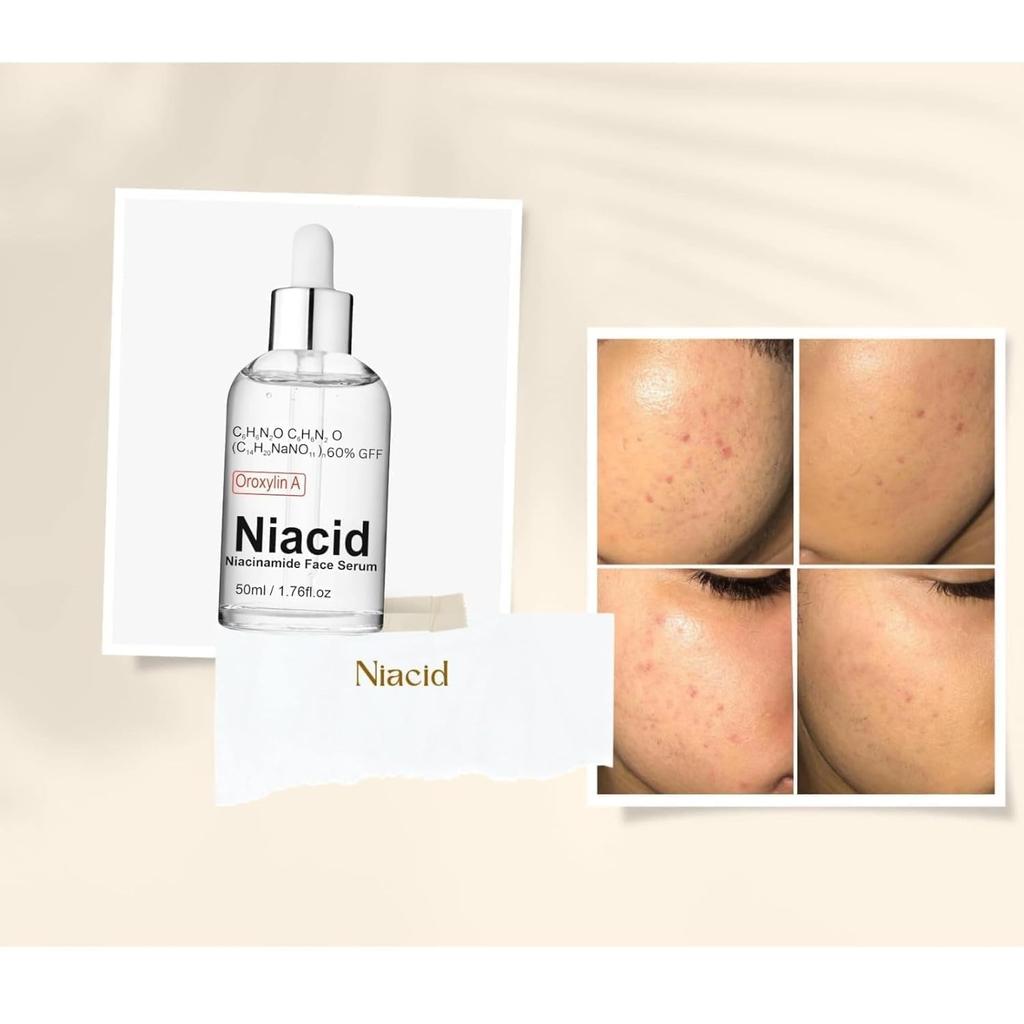 VIVAGLO Siero Viso Niacid Niacinamide 5% per Pelli Grasse Secche Miste Schiarente Protegge dal Sole Pori Dilatati Rassodante Cicatrici Pitting & Macchie Post-Acne Scure