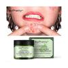 3Pcs JoyPretty Herbal Acne Removal Face Cream Against Pimple Remover Ance Treatment Anti Ance Moisturizing Repair Damage Skin Care