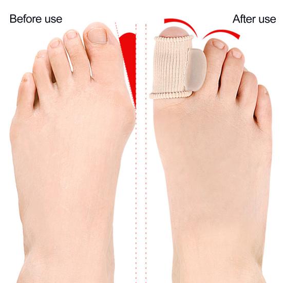 1/2Pcs Toe Separator Orthopedic Bunion Valgus Hammertoe Corrector Pain Relief